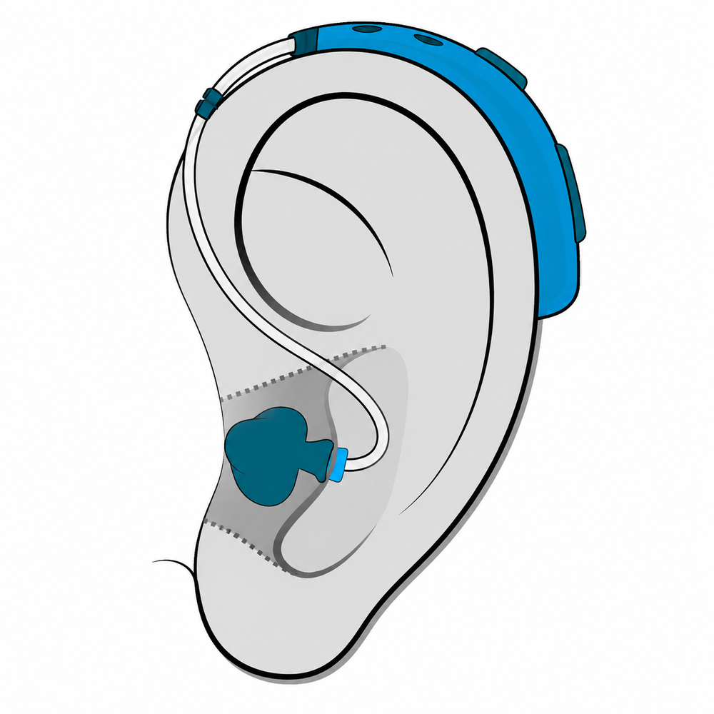 Behind-the-Ear (BTE) hearing aid style fitted at Hear Today Hearing Aids in Corpus Christi, TX