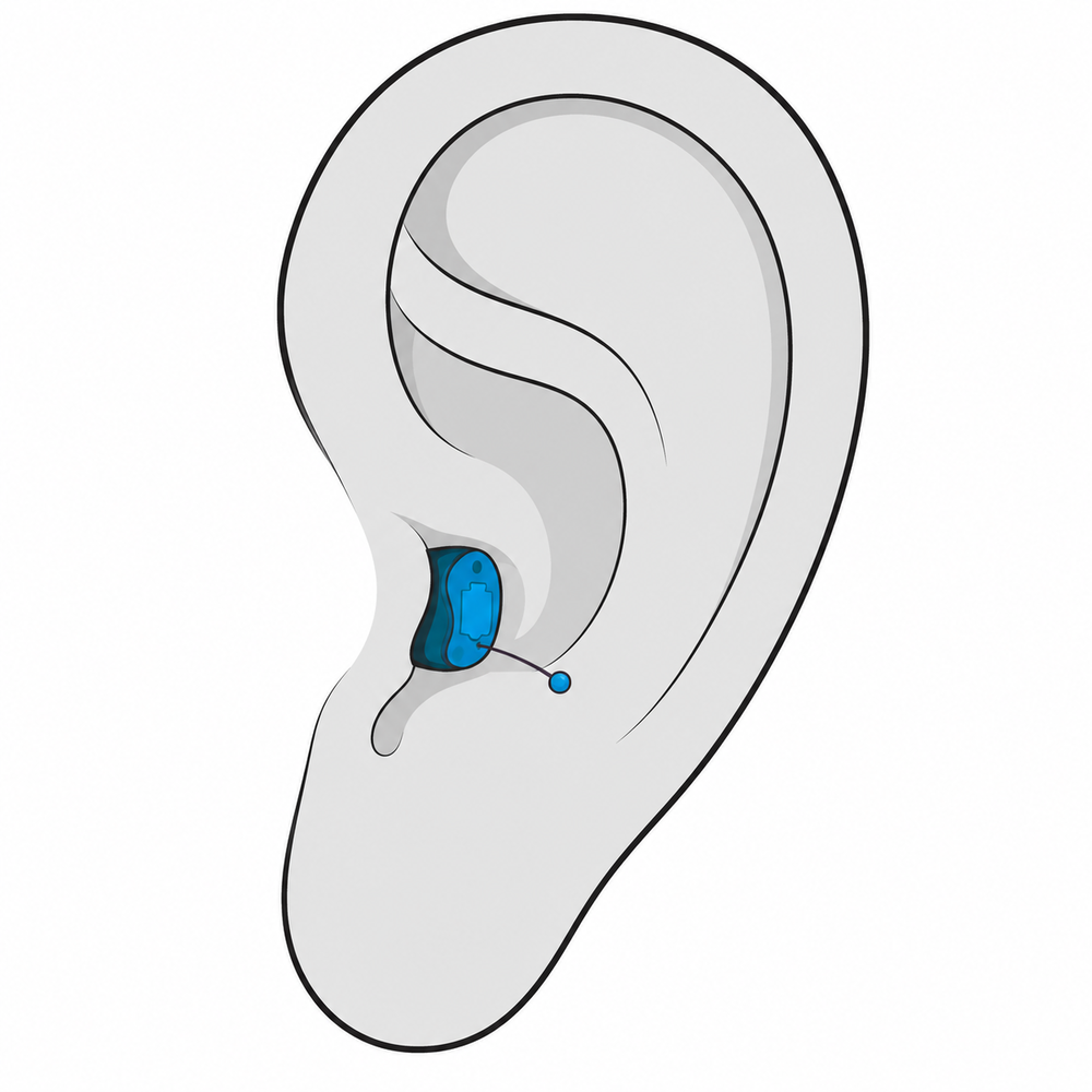 Completely-in-Canal (CIC) hearing aid style fitted at Hear Today Hearing Aids in Corpus Christi, TX