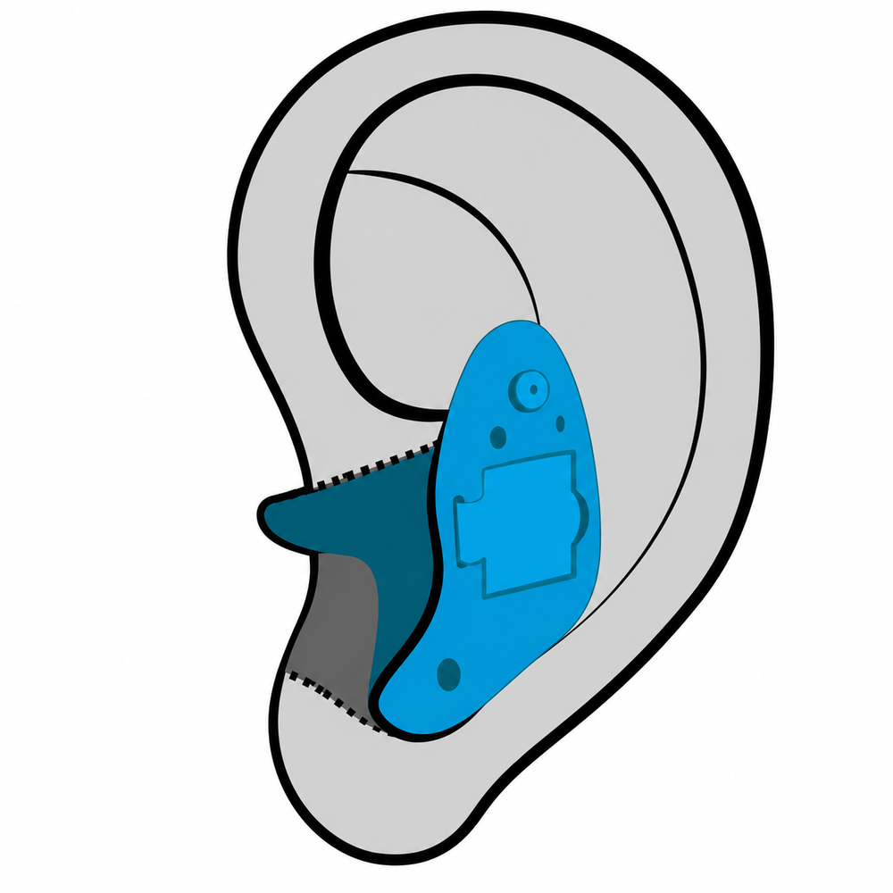 In-the-Ear (ITE) hearing aid style fitted at Hear Today Hearing Aids in Corpus Christi, TX