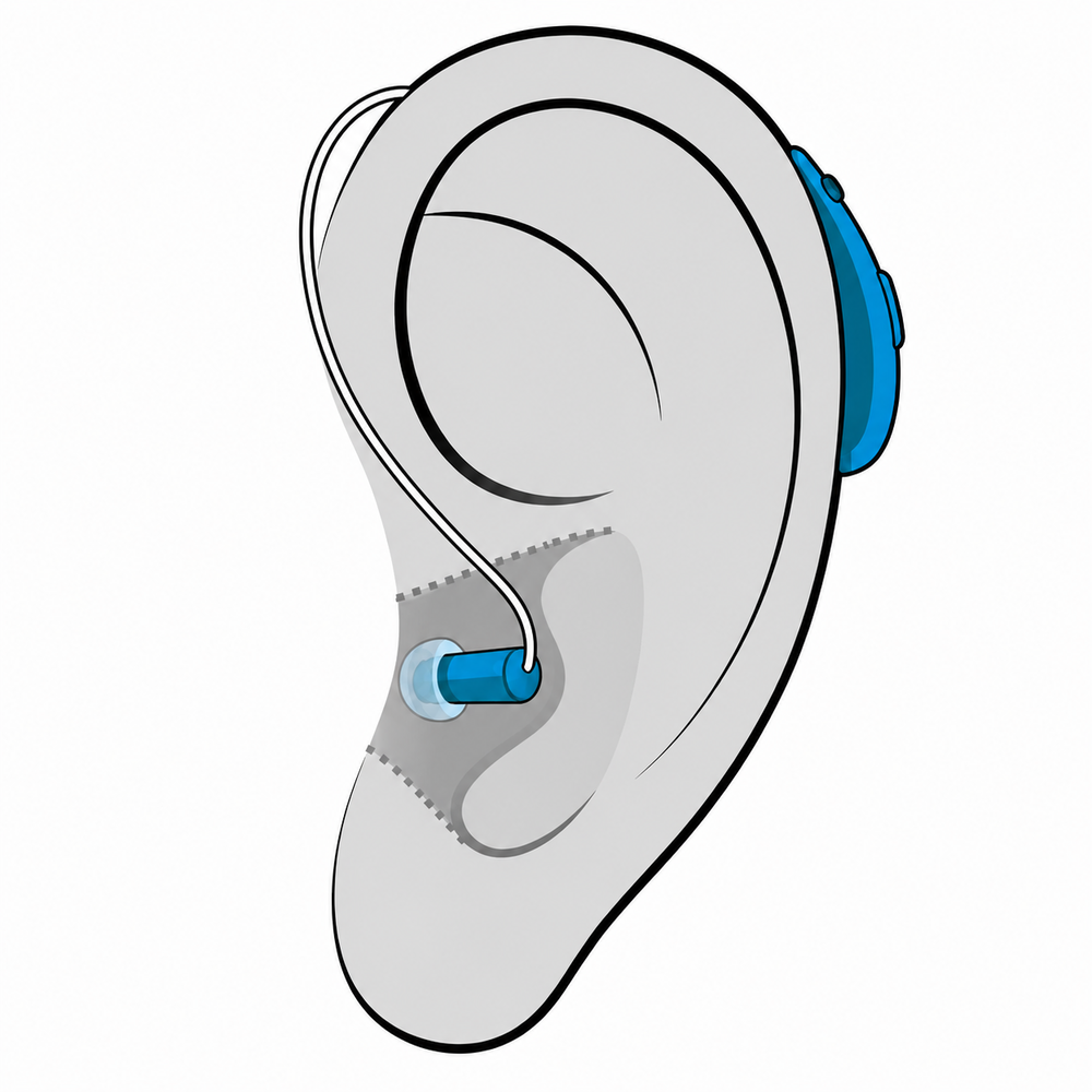 Receiver-in-Canal (RIC) hearing aid style fitted at Hear Today Hearing Aids in Corpus Christi, TX